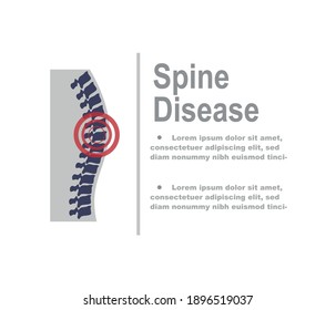 pain in spine icon vector isolated.
