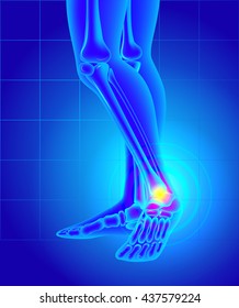 Pain and swelling on the inside of the ankle. Pain of a foot. Anatomy bones. X-ray of the skeleton and legs. Vector illustration created with gradient mesh.