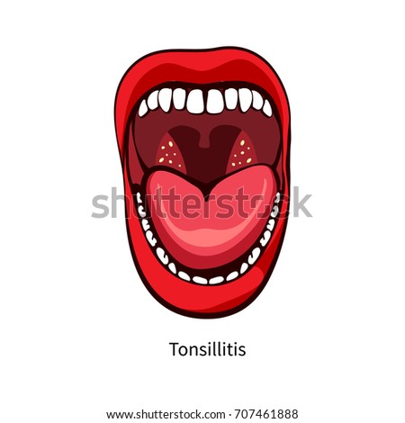 Sexy mouth tonsels pic variant Apologise, but, sexy mouth tonsels pic can