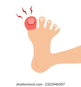 Pain trauma and swollen toe in flat design on white background.