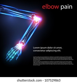 painful elbow illustration