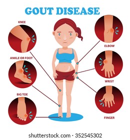 
Painful and inflamed gout on her body around the Bones and joints in the circle.