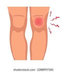 Painful knee injury on human leg flat vector illustration