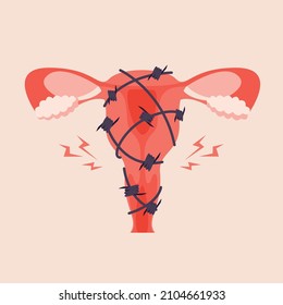 Painful menstruation concept trendy flat illustration. Uterus inflammation, endometriosis,  banner design. Cancer symptom, cycle problems, pms background.