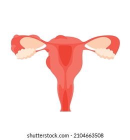 Painful menstruation concept trendy flat illustration. Uterus inflammation, endometriosis,  banner design. Cancer symptom, cycle problems, infertility background. 