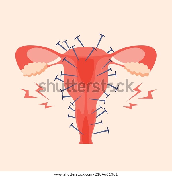 Painful menstruation concept trendy flat\
illustration. Uterus inflammation, endometriosis,  banner design.\
Cancer symptom, cycle problems, pms\
background.
