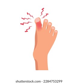 Painful toe injury on human foot flat vector illustration