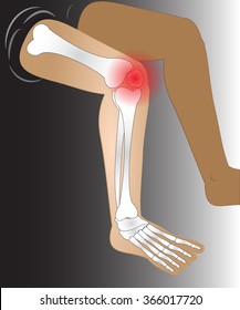 painfull knee joint catched, illustration vector