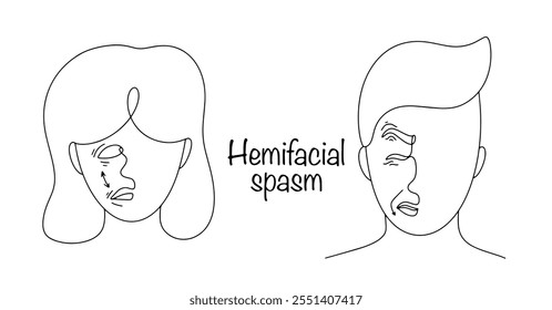 Contracciones involuntarias e indoloras de la mitad de la cara causadas por la interrupción del nervio facial. Un hombre y una mujer con síntomas de espasmo hemifacial. Línea de Ilustración vectorial médica.