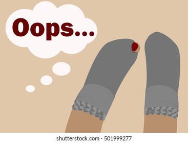 A Pair of Holey Socks.
