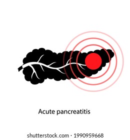 Logo de la enfermedad del páncreas, pancreatitis aguda. Nombramiento médico y tratamiento en clínica. Dolor e inflamación en el aparato digestivo. Organismos internos humanos examen anatómico ilustración vectorial plana