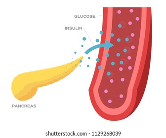 Pancreas And Insulin In Blood Vector