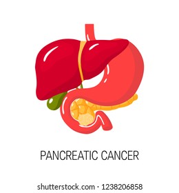 Pancreatic cancer concept. Medical vector illustration of pancreas, duodenum, gallbladder, liver and stomach