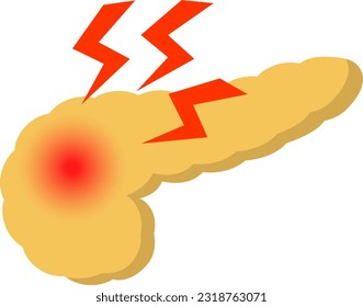 Pancreatic malfunction isolated vector illustration.