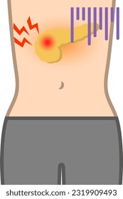 Pancreatic malfunction isolated vector illustration.