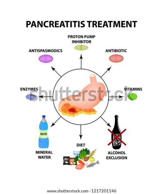 Pancreatitis Treatment Structure Stomach Pancreas Infographics Stock ...