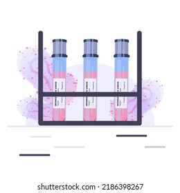 Pandemic Monkeypox outbreak. Blood sample tube for Monkeypox virus test in the laboratory. Monkey pox virus cells outbreak medical vector illustration