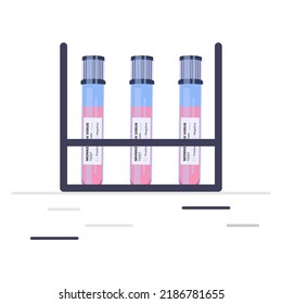 Pandemic Monkeypox outbreak. Blood sample tube for Monkeypox virus test, medical vials and flasks in the laboratory. Monkey pox virus cells outbreak medical vector illustration