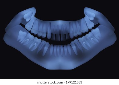 Panoramic dental X-Ray. Vector illustration eps.10