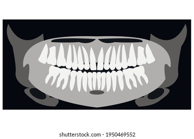 panoramic photo of teeth isolated on white. Stock vector illustration