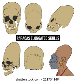 Paracas Skulls, Different Views Of Skulls, Paracas Man Side View.