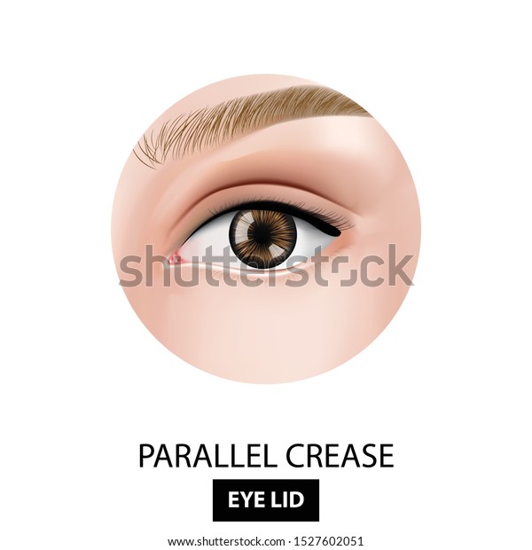 parallel eyelid