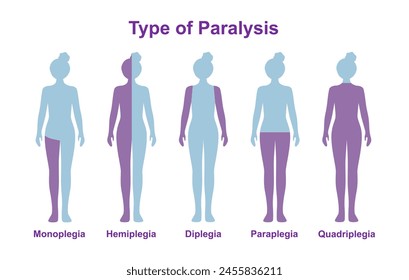 Paralysis types, spinal cord injury. Stroke, tumor, nerve damage brain. Face palsy.