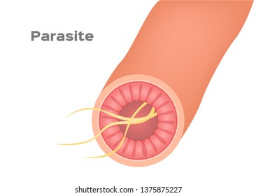 parasite in stomach and intestine vector