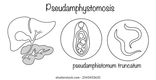A parasitic disease caused by trematodes that infect the bile ducts and sometimes the pancreas of humans and animals. Infection occurs through consumption of infected fish. Black and white vector.