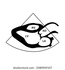 Parasternal long axis view, heart disease