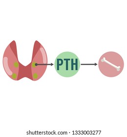 Parathyroid Hormone (PTH), Is A Hormone Secreted By The Parathyroid Glands That Is Important In Bone Remodeling