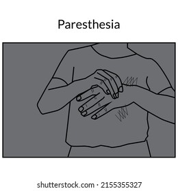 Paresthesia Line Art Stock Illustration. The Vector Image Relates To A Burning Or Tingling Sensation In The Hands