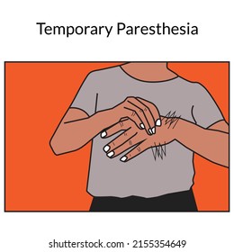 Paresthesia Stock Illustration. The Vector Image Relates To A Burning Or Tingling Sensation In The Hands