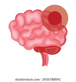 parkinson brain condition illustration vector