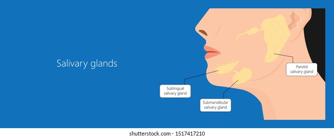 Parotid gland Sialadenitis bacterial infection Sialolithiasis blockage swelling treat Infiltrative cancer ear nose doctor calculi stones diagnose surgical examination inflammation saliva