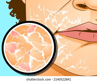 La parte del cuerpo humano. La boca con problemas de piel. Alergia y piel seca.  Ilustración sanitaria. Ilustración vectorial.