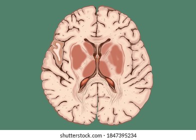 Partial human brain view from below or middle.