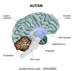 Parts of the brain affected by autism. Vector diagram