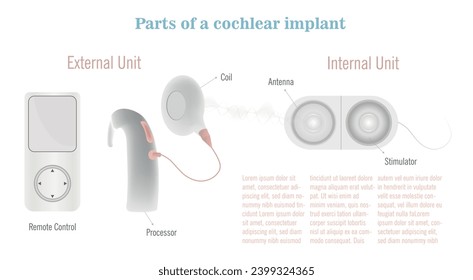 Parts of a cochlear implant from the remote control, the external part that is placed in the ear and then the internal part that is implanted in the head.