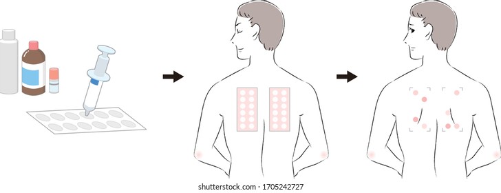 
Patch test procedure and men taking patch test