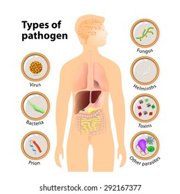 pathogen: virus, bacteria, prion, fungus, Helminths, Toxins and  other parasite. Types of pathogen. human anatomy. Human silhouette with highlighted internal organs