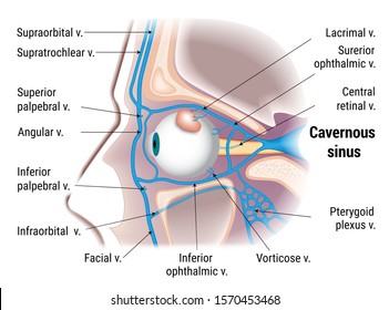 Pathogenesis Of Cavernous Sinus Thrombosis. Study Guide, Vector Illustration.