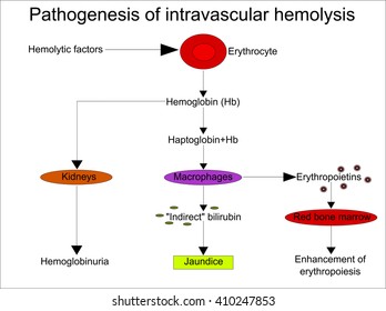 Pathogenesis of intravascular hemolysis 