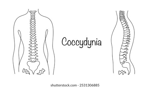 Uma condição patológica que se manifesta como dor persistente na região do cóccix. Homem puxado à mão com sintomas de coccicogenia. Vetor isolado no fundo branco. 