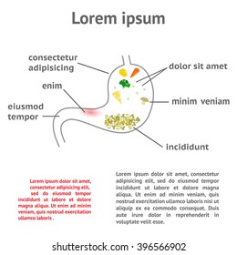 pathology of the stomach and digestive illustration