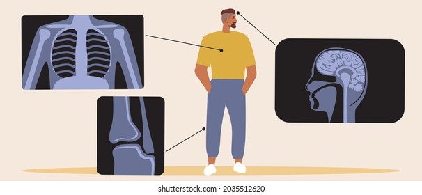 Patient with MRI scan, comprehensive examination. Flat vector stock illustration. MRI or computer tomogram. Patient diagnostics. MRI of the brain, joints, lungs. Vector graphics