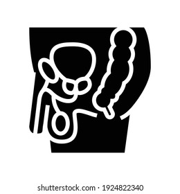 paciente con vector de icono de glifo de próstata. paciente con signo de próstata. símbolo de contorno aislado ilustración negra