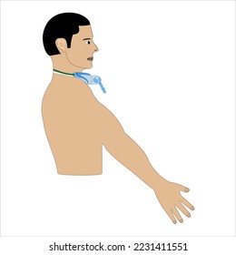 Patient with tracheostome and tracheostomy mask seen in profile
