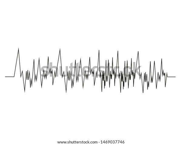sound bar vibration