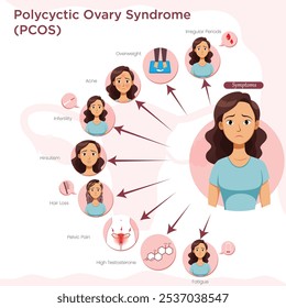 Os sintomas da SOP incluem períodos irregulares, ganho de peso, acne, desbaste do cabelo, excesso de pelos faciais e dificuldade para conceber.